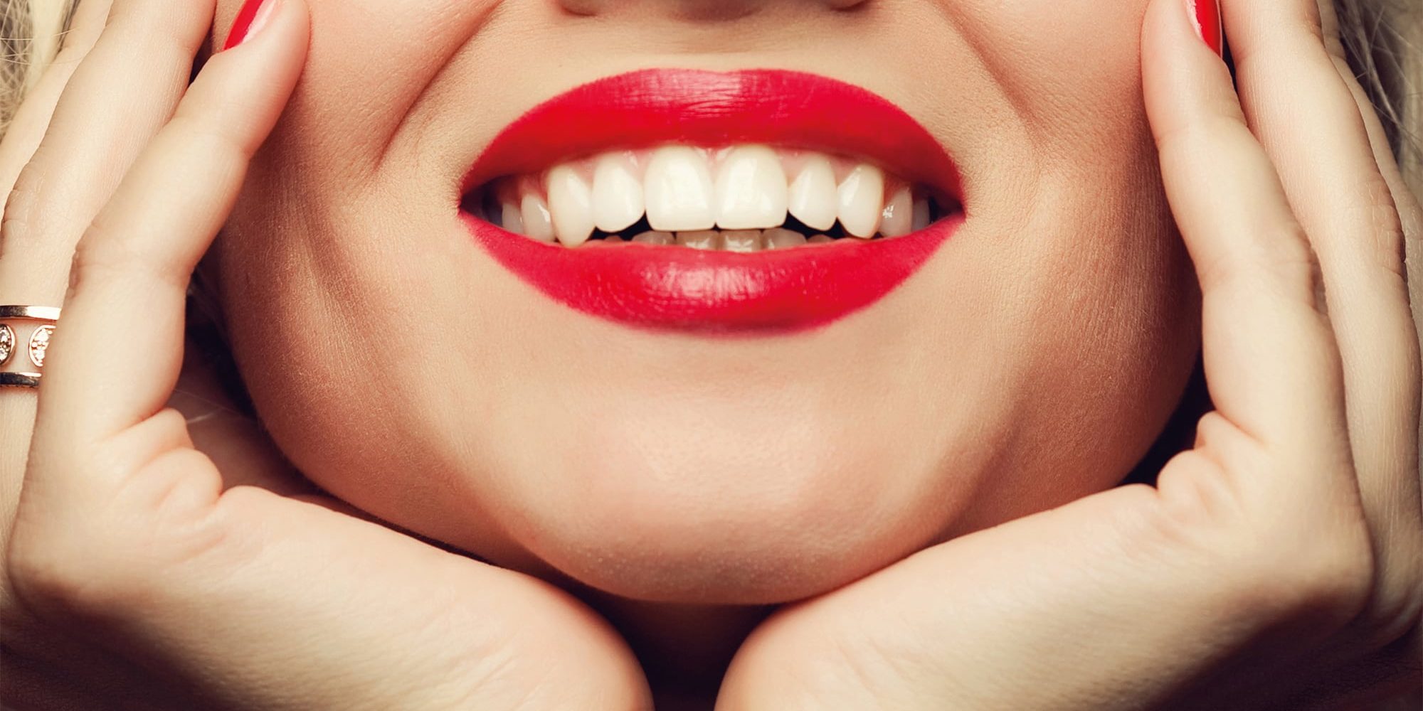 Campagna-Luxury-Smile